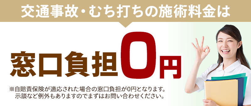事後負担
